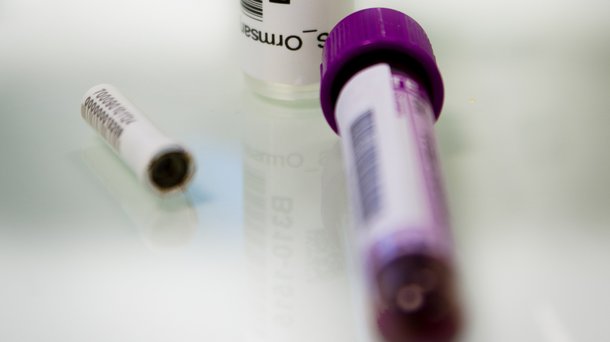 HG R&D Tissue samples Hypor_Landcatch and blood samples ISA_Hybrid.jpg
